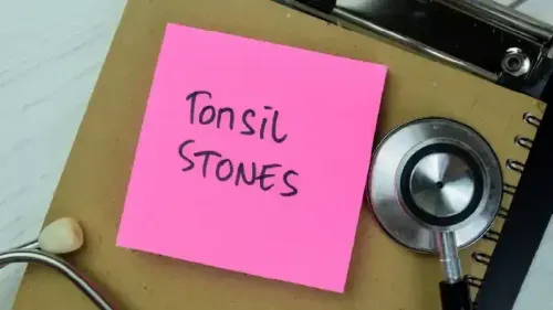 What are the 6 Home Remedies for Tonsil Stones?